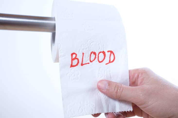 Treatment for blood in stool