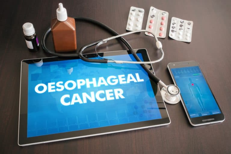 Understanding Oesophageal Cancer | Sydney Gut Clinic