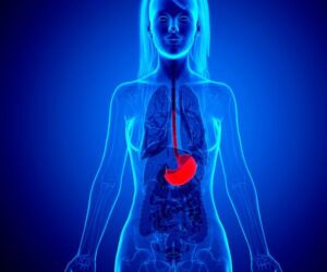 Barrett’s oesophagus metaplasia